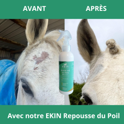 Repousse du poil Ekin Repousse du poil Ekin