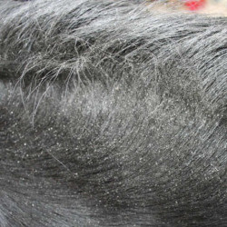 Répulsif Animaderm Derfly Répulsif Animaderm Derfly