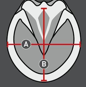 Illustratie van de maattabel voor Hoefschoenen paard Equine Fusion